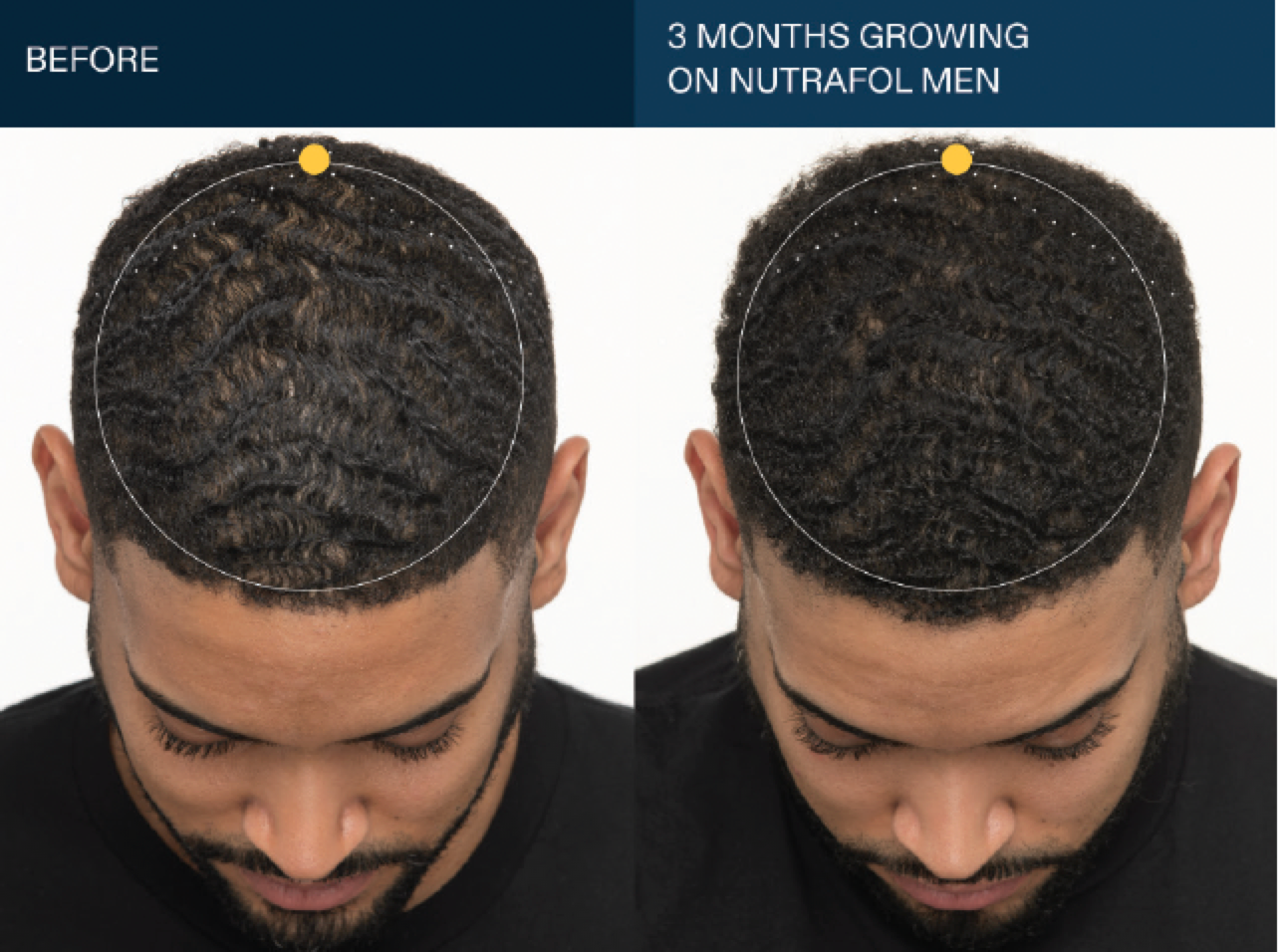 Nutrafol Men's Growth Pack