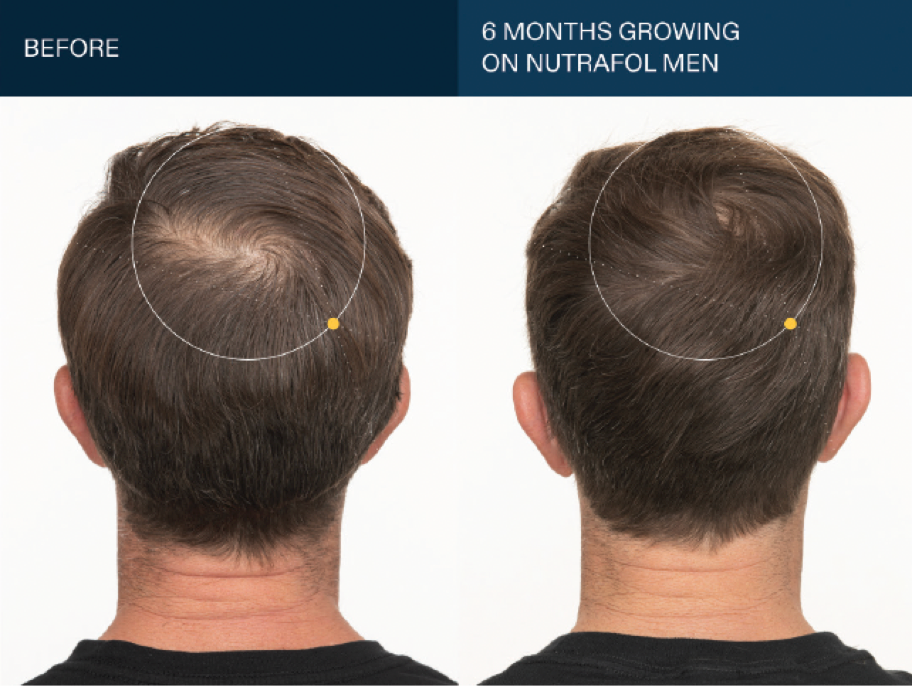 Nutrafol Men's Growth Pack