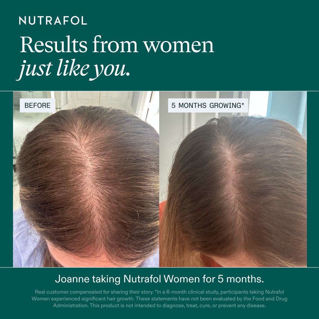 Nutrafol Women's Balance Growth Pack
